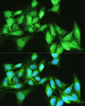 KDM7A Antibody