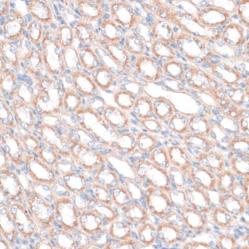 PDGFD Antibody