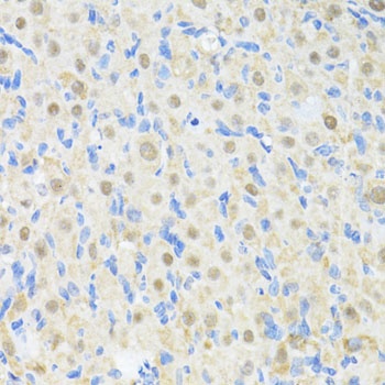 PRKAG2 Antibody