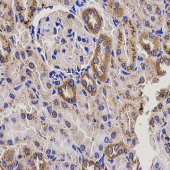 EPHX2 Antibody
