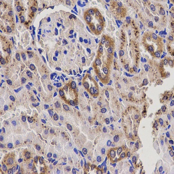 EPHX2 Antibody