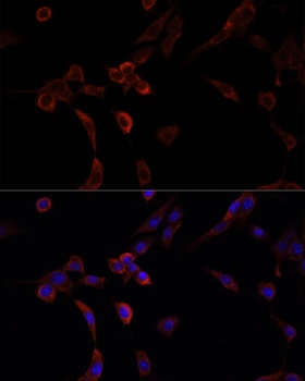 NRF1 Antibody