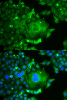 CACNG4 Antibody