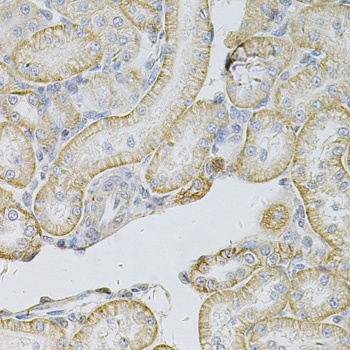 MSLN Antibody
