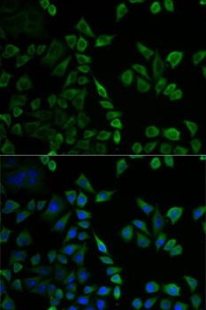 MSLN Antibody