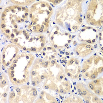 ZNF264 Antibody