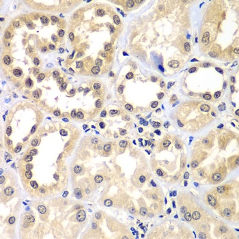 ZNF264 Antibody