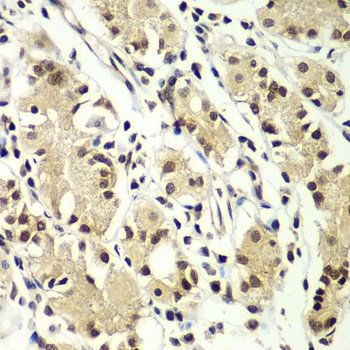 ZNF264 Antibody