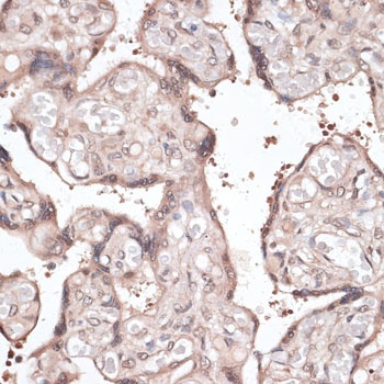 CCNE2 Antibody