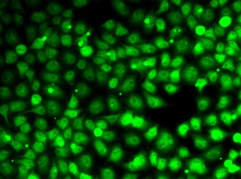 CCNE2 Antibody