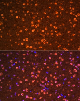 OTX2 Antibody