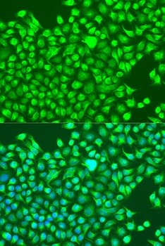 GRIN1 Antibody