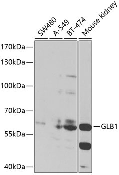 GLB1 Antibody