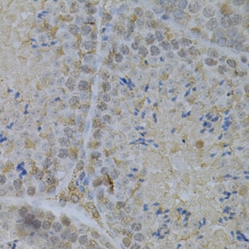 GLB1 Antibody