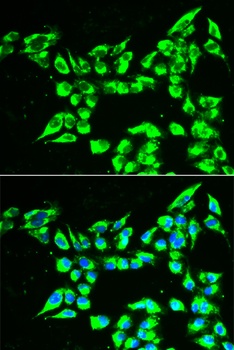 KLK10 Antibody