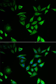 NUTF2 Antibody