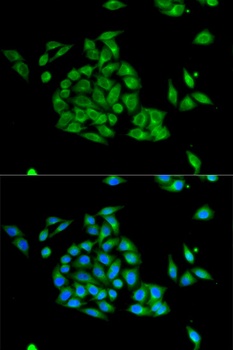 PICK1 Antibody