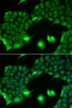 SSX2 Antibody