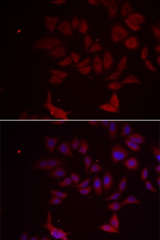 RPL11 Antibody
