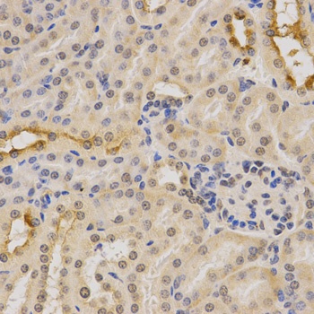 PDHA1 Antibody