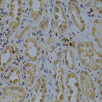 PDHA1 Antibody