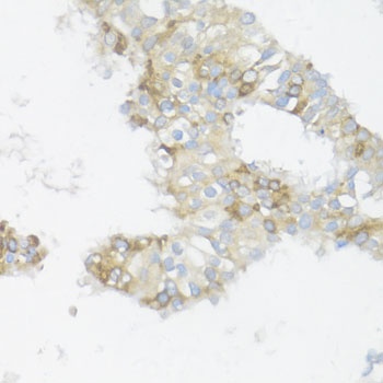 BCL2L2 Antibody