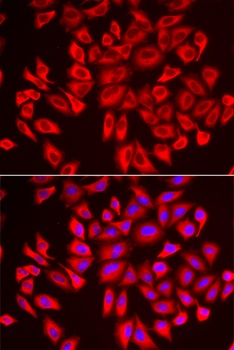 DCAF7 Antibody