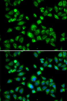 MBTPS1 Antibody