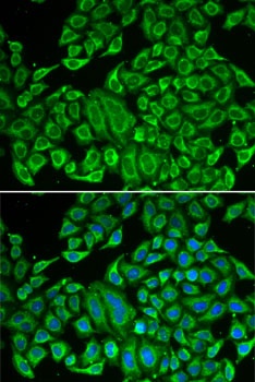 IL12RB1 Antibody