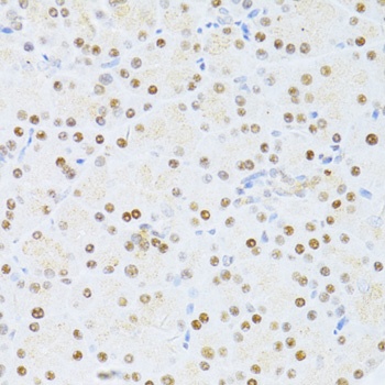 ETV1 Antibody