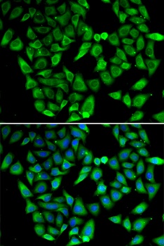 ASIP Antibody