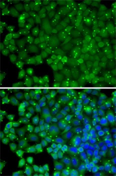 ARRB2 Antibody