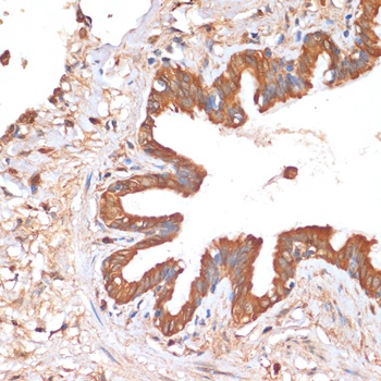 HHLA2 Antibody