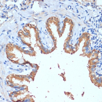 HHLA2 Antibody