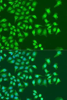 NIN Antibody