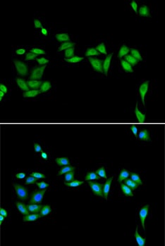 JADE1 Antibody