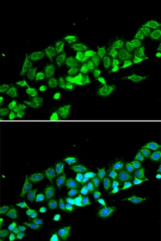 RASSF1 Antibody