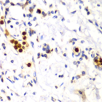S100A12 Antibody