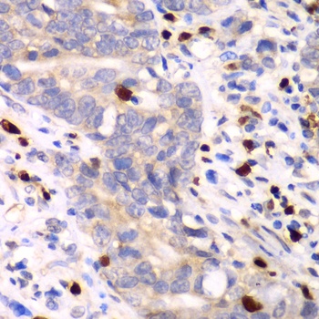 S100A12 Antibody