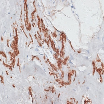 ELN Antibody