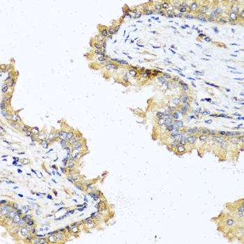 DEFB121 Antibody