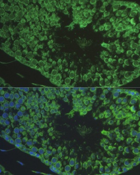 DEFB121 Antibody