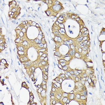 KRT7 Antibody