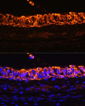 KRT7 Antibody