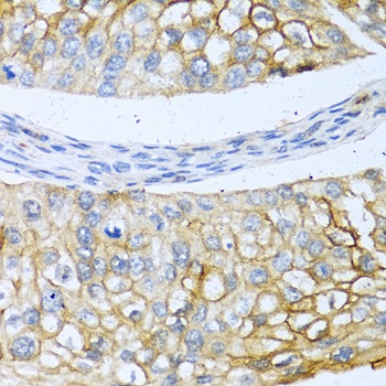 BMP4 Antibody