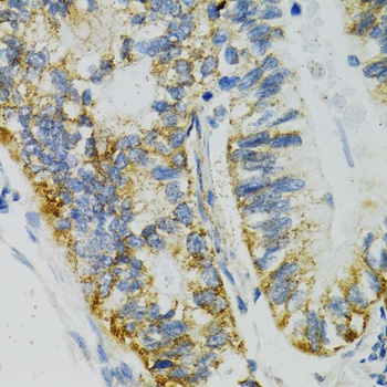 SLC27A2 Antibody