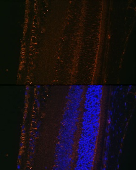 LOXL1 Antibody
