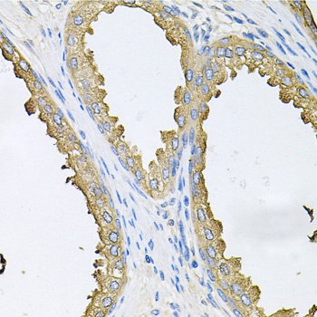 ABL1 Antibody