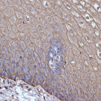 TMPRSS2 Antibody [ARC2373]