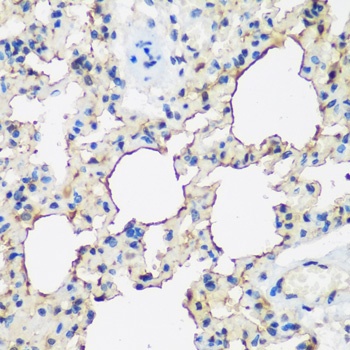 ALOX15 Antibody